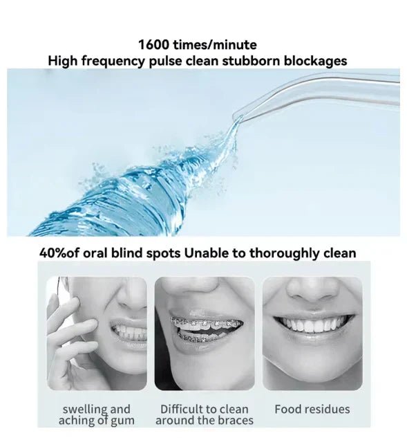 Oral Irrigator – Find Your Beauty - Veyrx.store