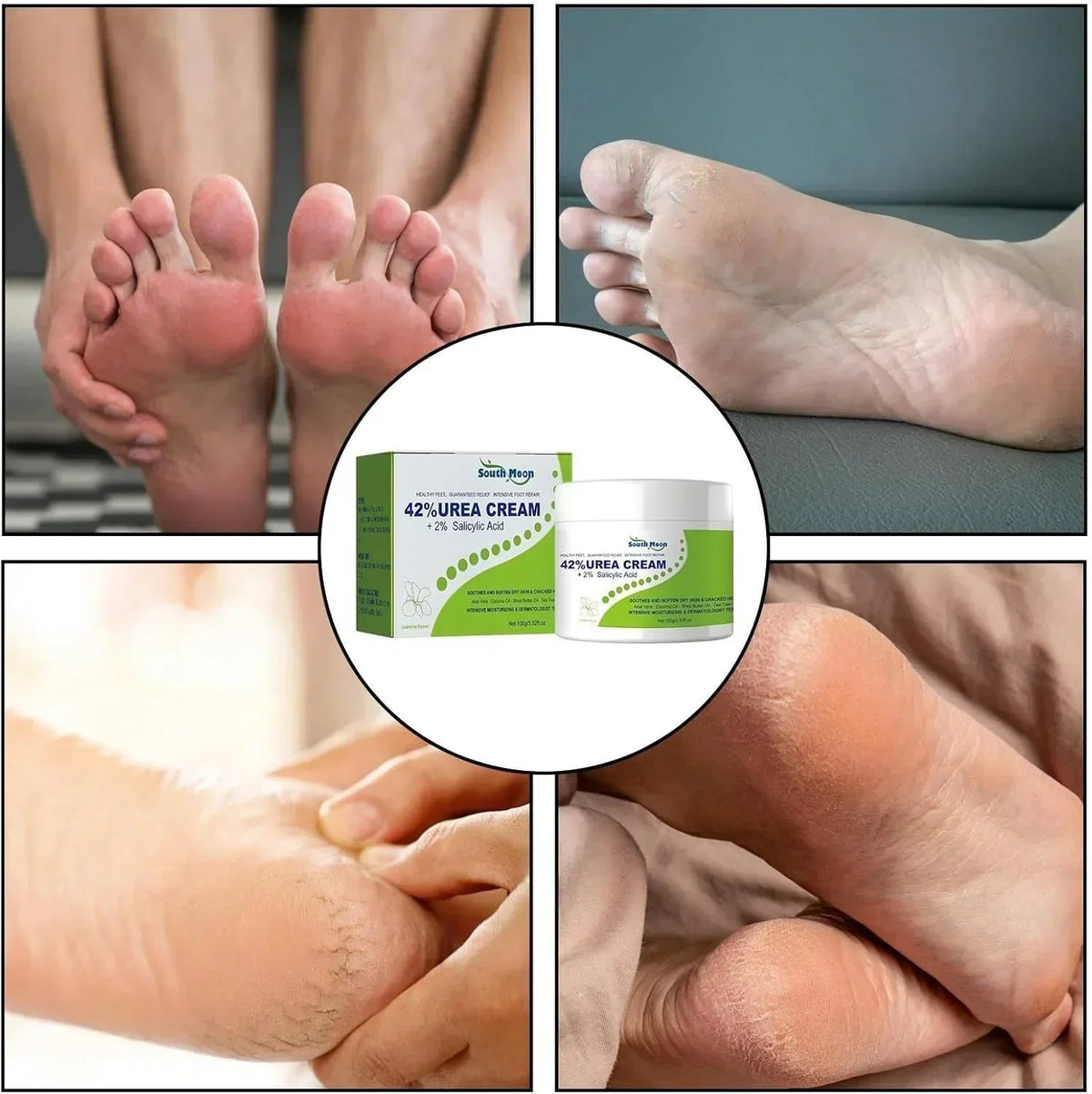 South Moon - 42% Urea Cream + 2% Salicylic Acid (Original) - Veyrx.store