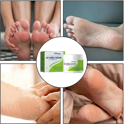 South Moon - 42% Urea Cream + 2% Salicylic Acid (Original) - Veyrx.store